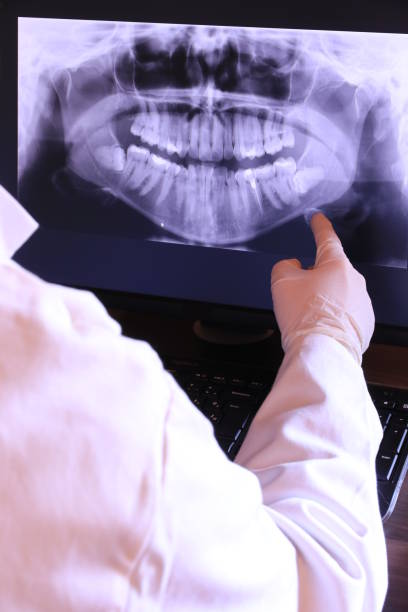 Best Knocked-Out Tooth (Avulsed Tooth) Treatment in Beaverton, MI